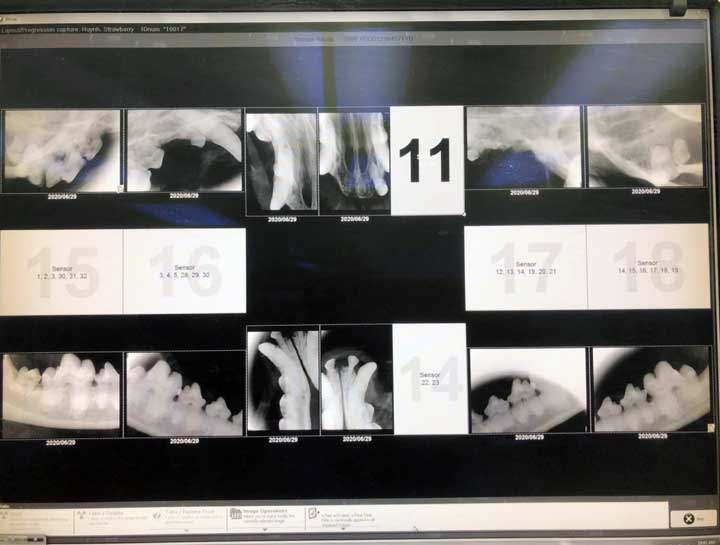 Digital Dental Radiology