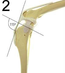 Typical Joint Angle
